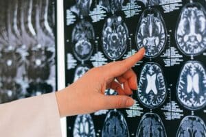 Does Understanding The Science of Addiction Help Reduce Relapse?